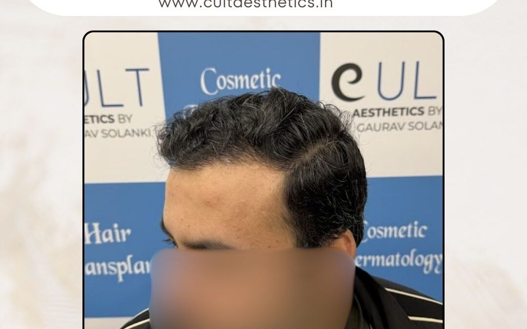 Hair Case 414 After 2