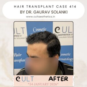 hair case 414 After-2