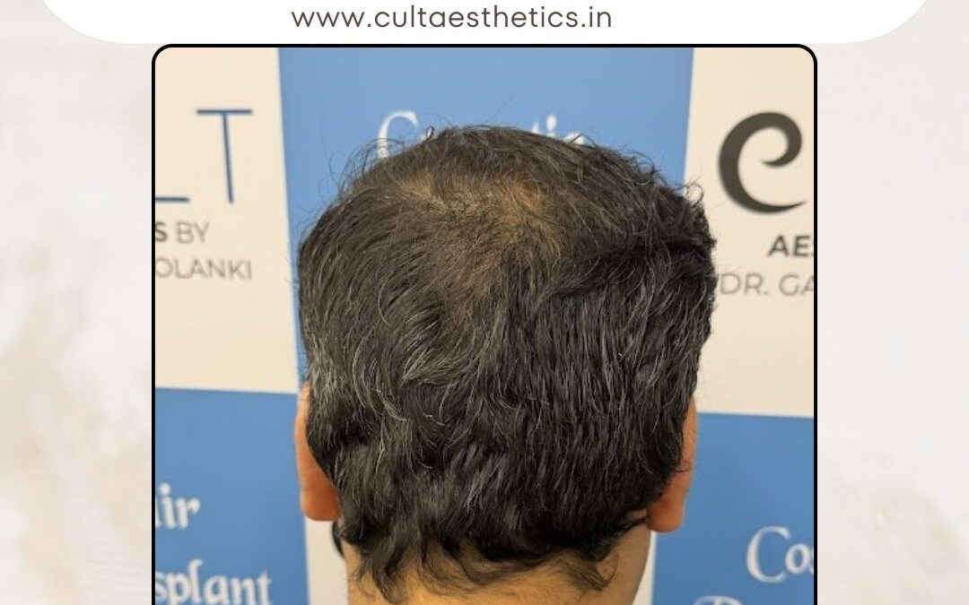 Hair Case 414 After 4