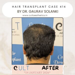 hair case 414 After-4