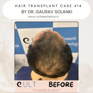 hair case 414 Before-3