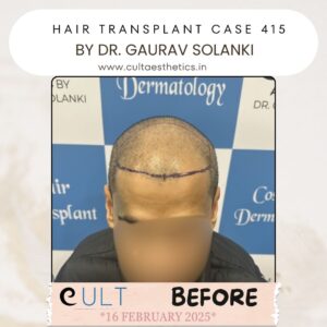 Hair case 415 Before-1