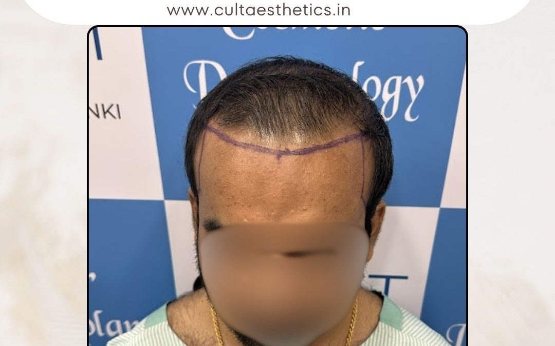 Hair Case 418 Before 1