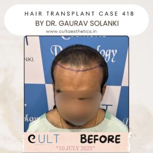 Hair case 418 Before-1