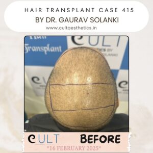 hair case 415 Before-2
