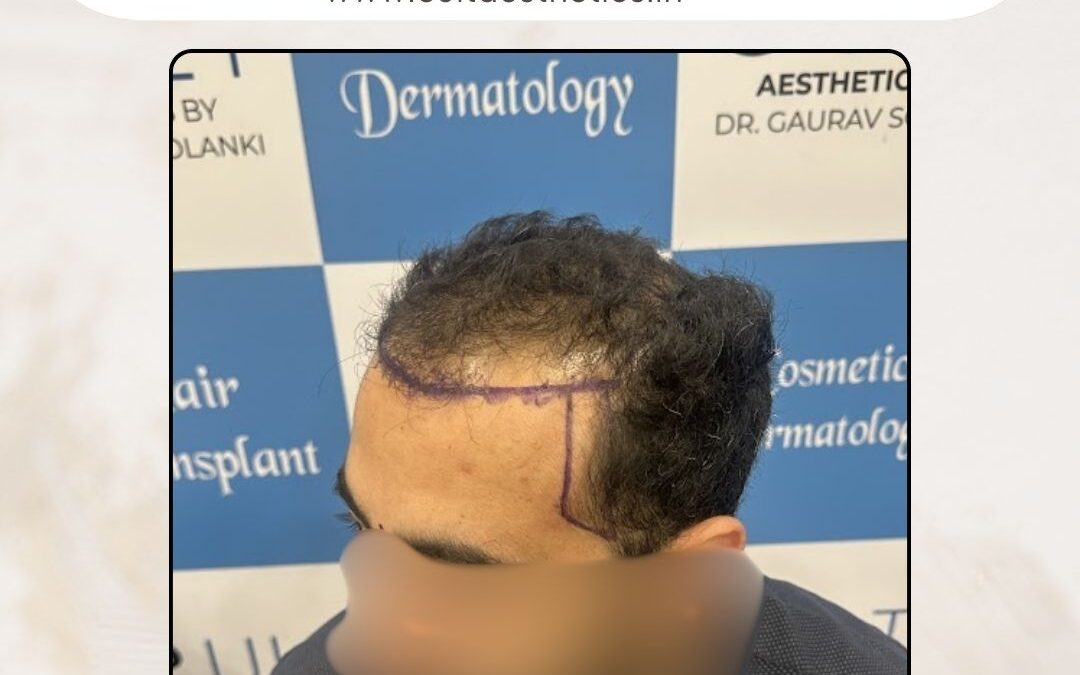 Hair Case 416 Before 3