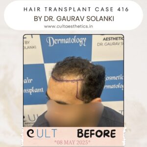 hair case 416 Before-3