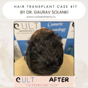 hair case 417 After-2