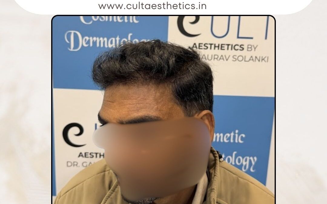 Hair Case 417 After 3