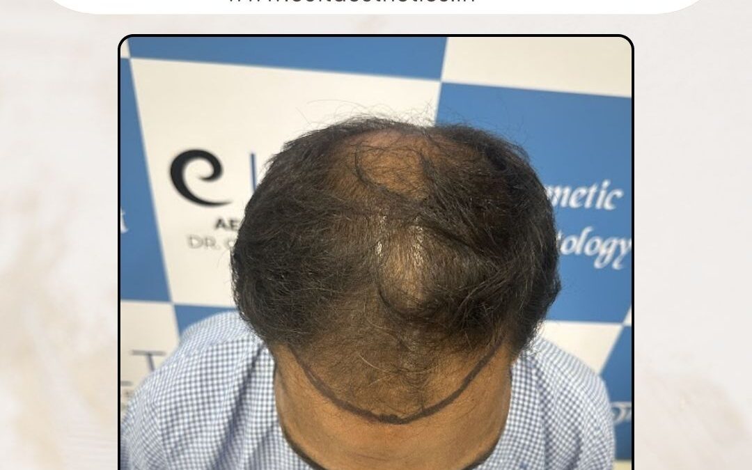 Hair Case 417 Before 3