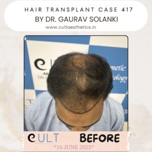 hair case 417 Before-3