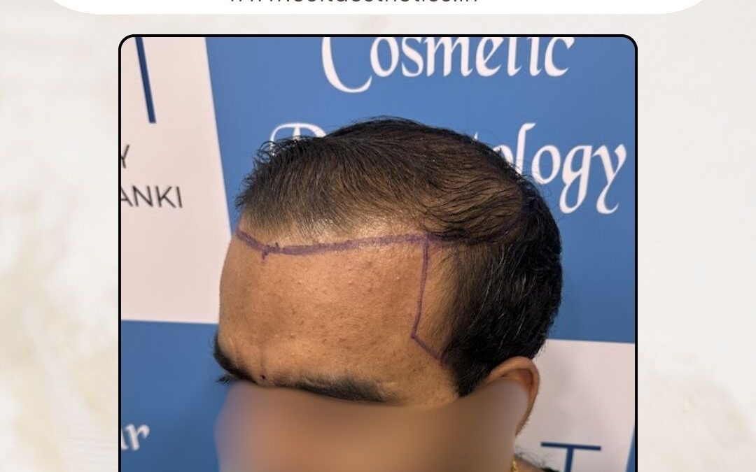 Hair Case 418 Before 3