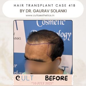 hair case 418 Before-3