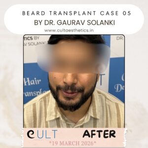 Beard case 05 After-3