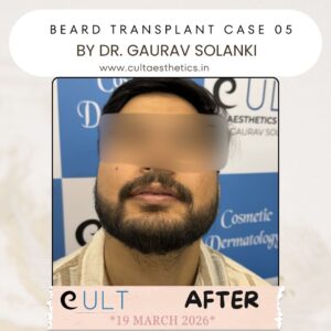 Beard case 05 After-4