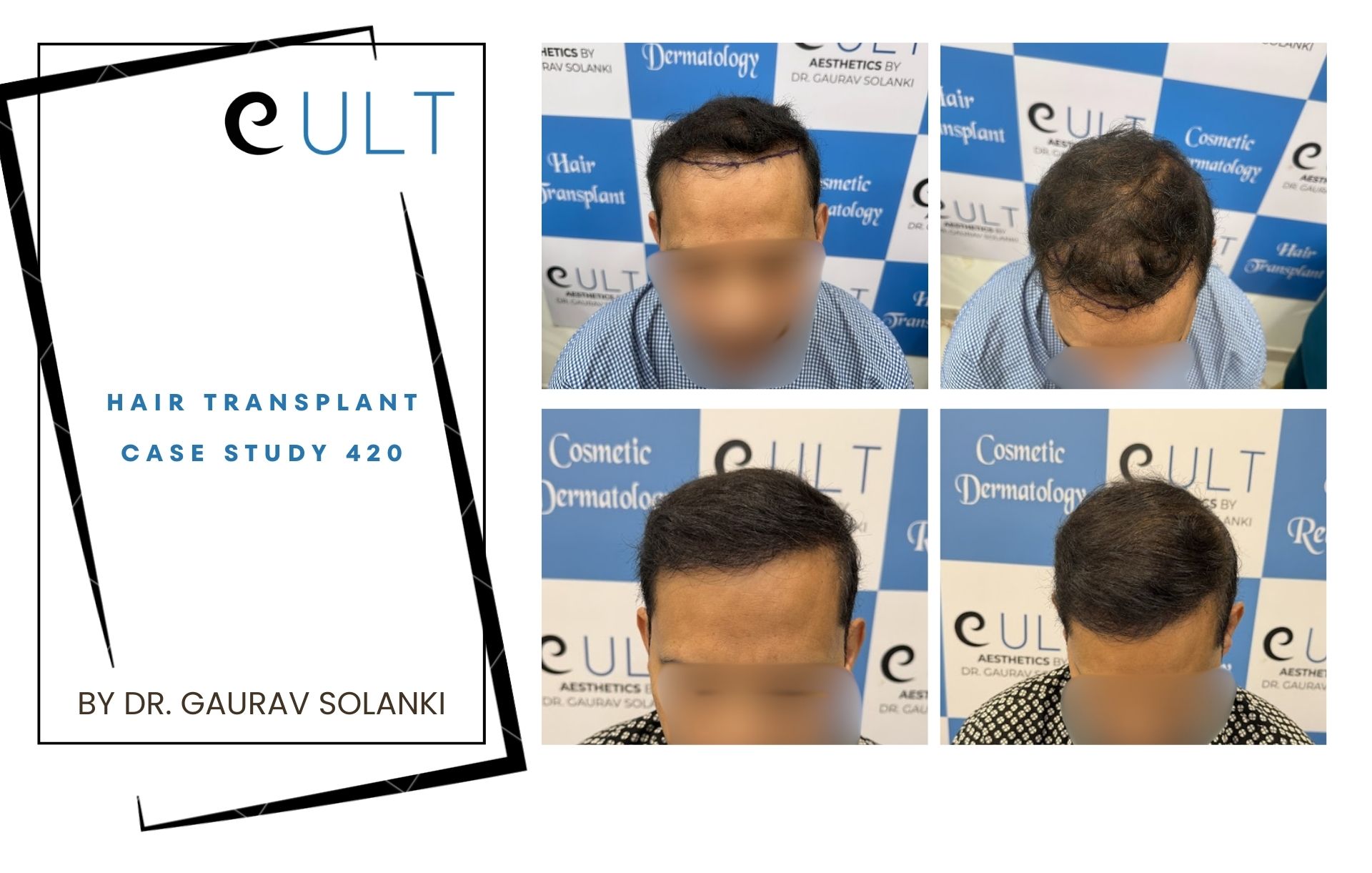 Hair Transplant case 420
