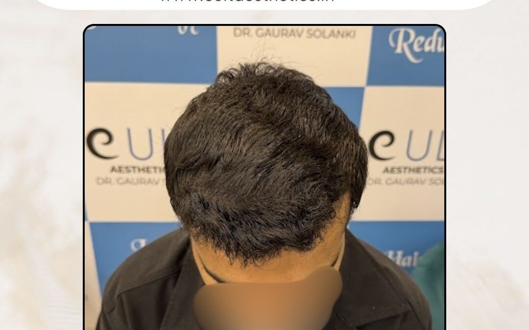 Hair Case 419 After 1