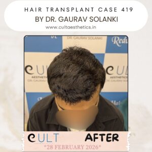 hair case 419 After-1