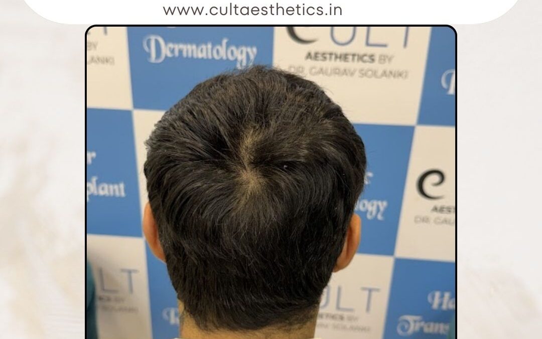 Hair Case 419 After 4