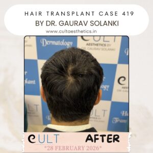 hair case 419 After-4