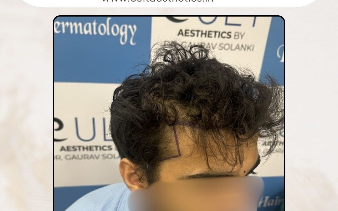 Hair Case 419 Before 2