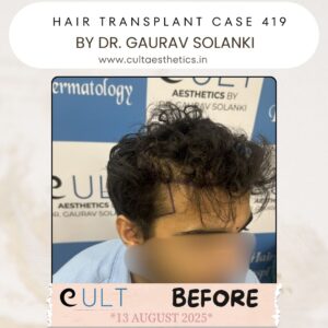 hair case 419 Before-2