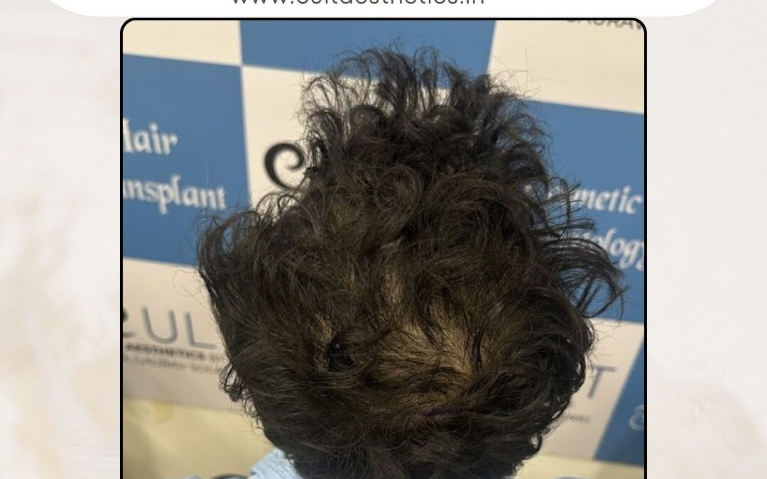 Hair Case 419 Before 4