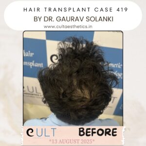 hair case 419 Before-4