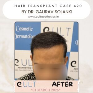 hair case 420 After-1