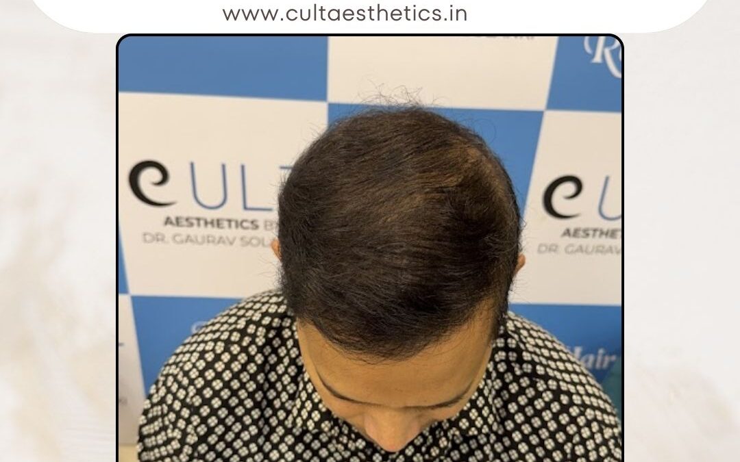 Hair Case 420 After 4