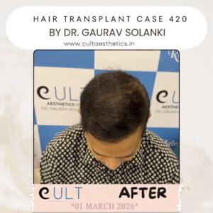 hair case 420 After-4