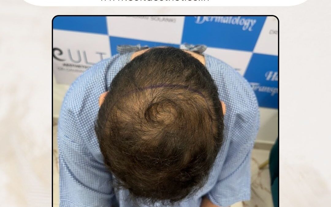 Hair Case 420 Before 3