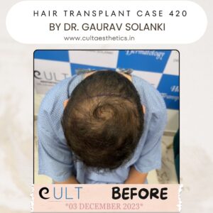 hair case 420 Before-3