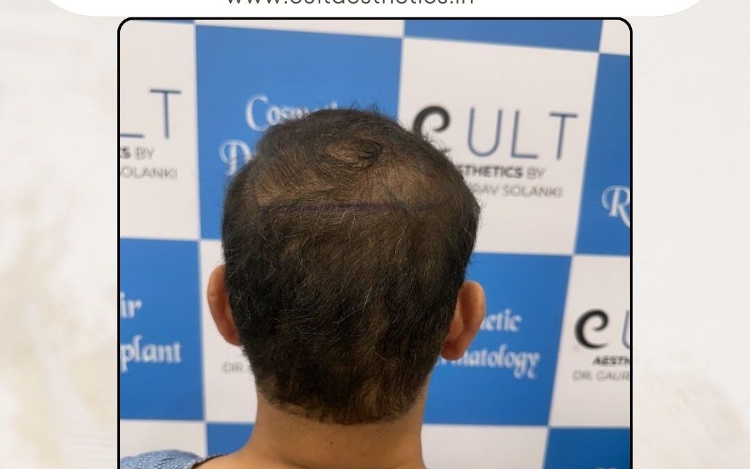 Hair Case 420 Before 4