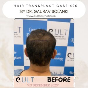 hair case 420 Before-4