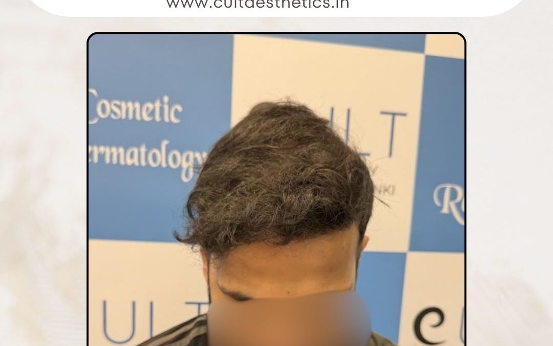 Hair Case 421 After 2