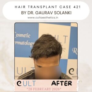 hair case 421 After-2