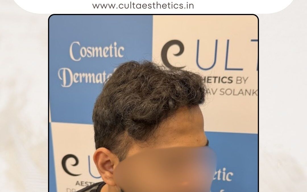 Hair Case 421 After 3