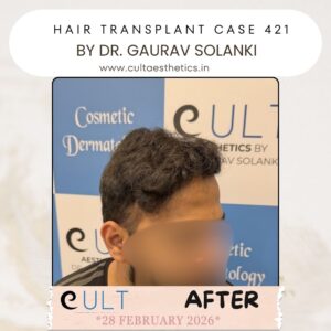hair case 421 After-3