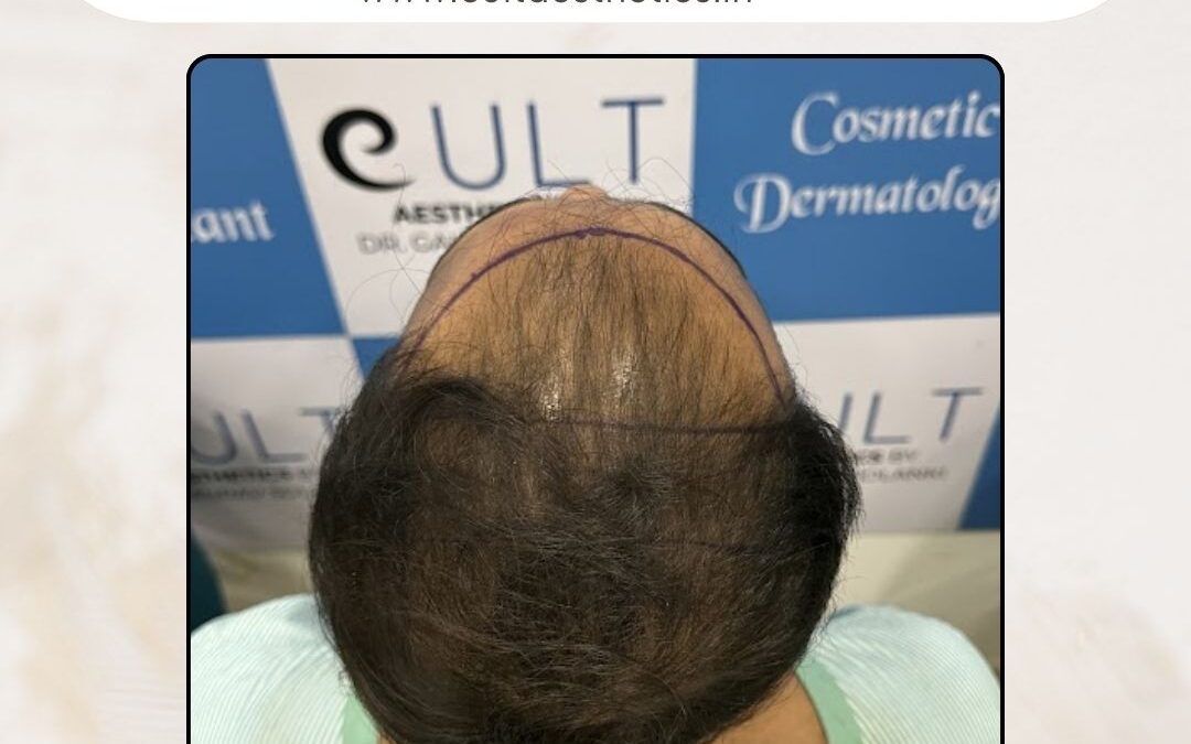 Hair Case 421 Before 3