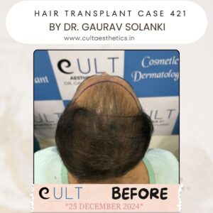 hair case 421 Before-3