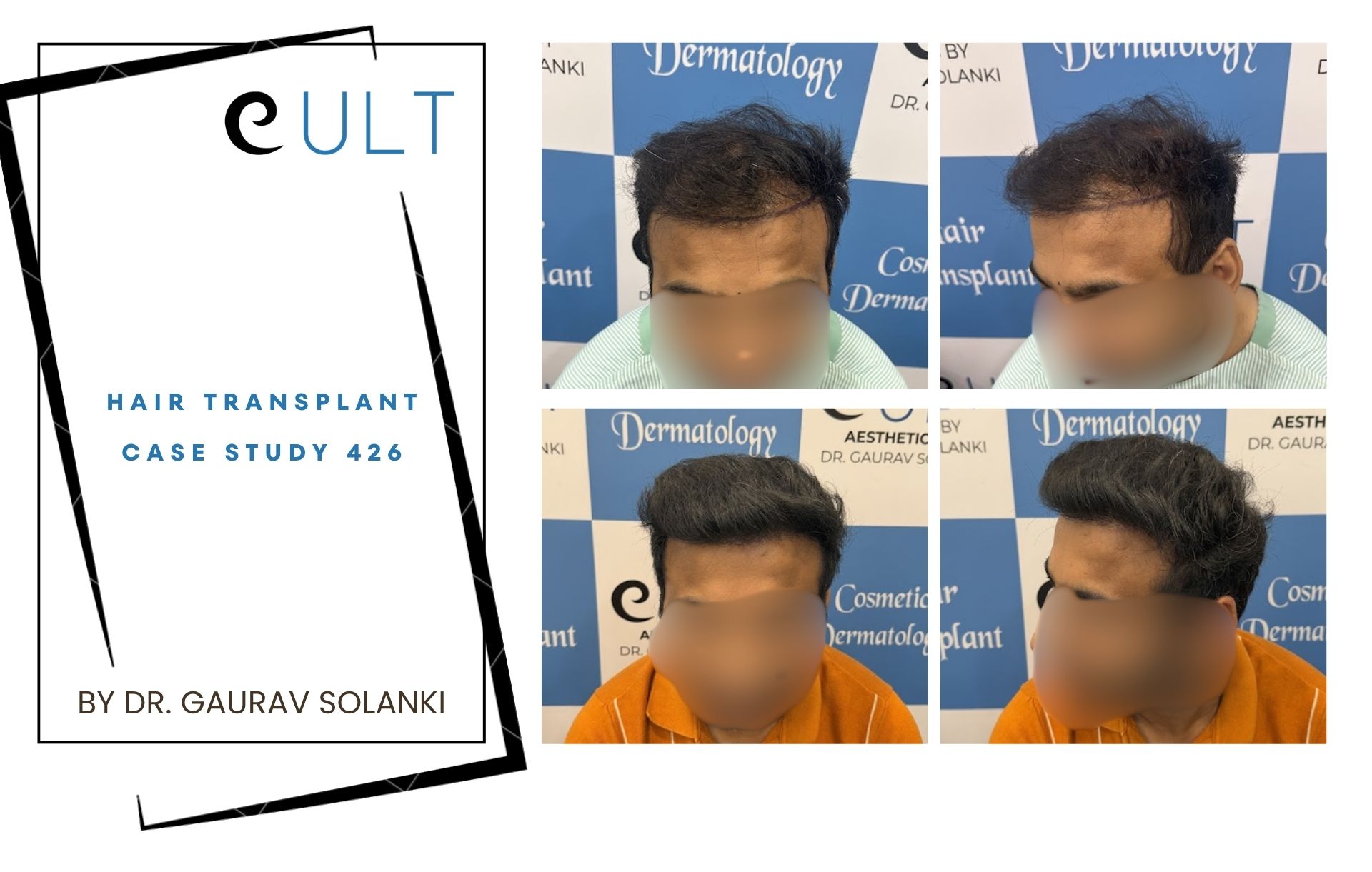 Hair Transplant case 426 Hair Transplant case 420