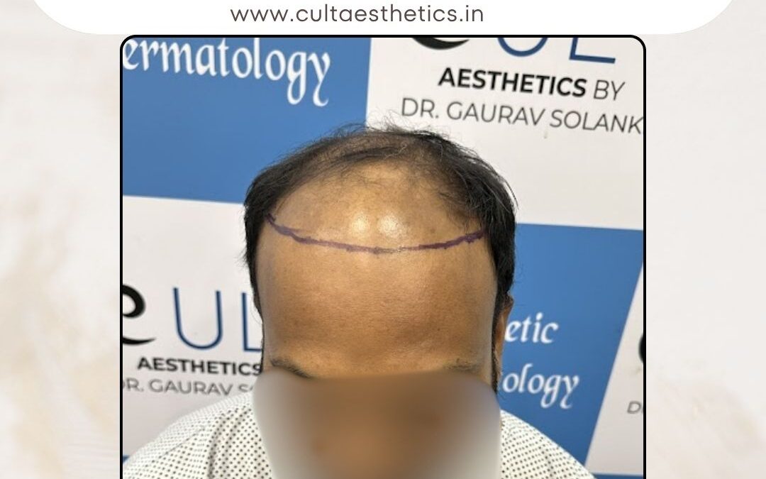 Hair Case 422 Before 1