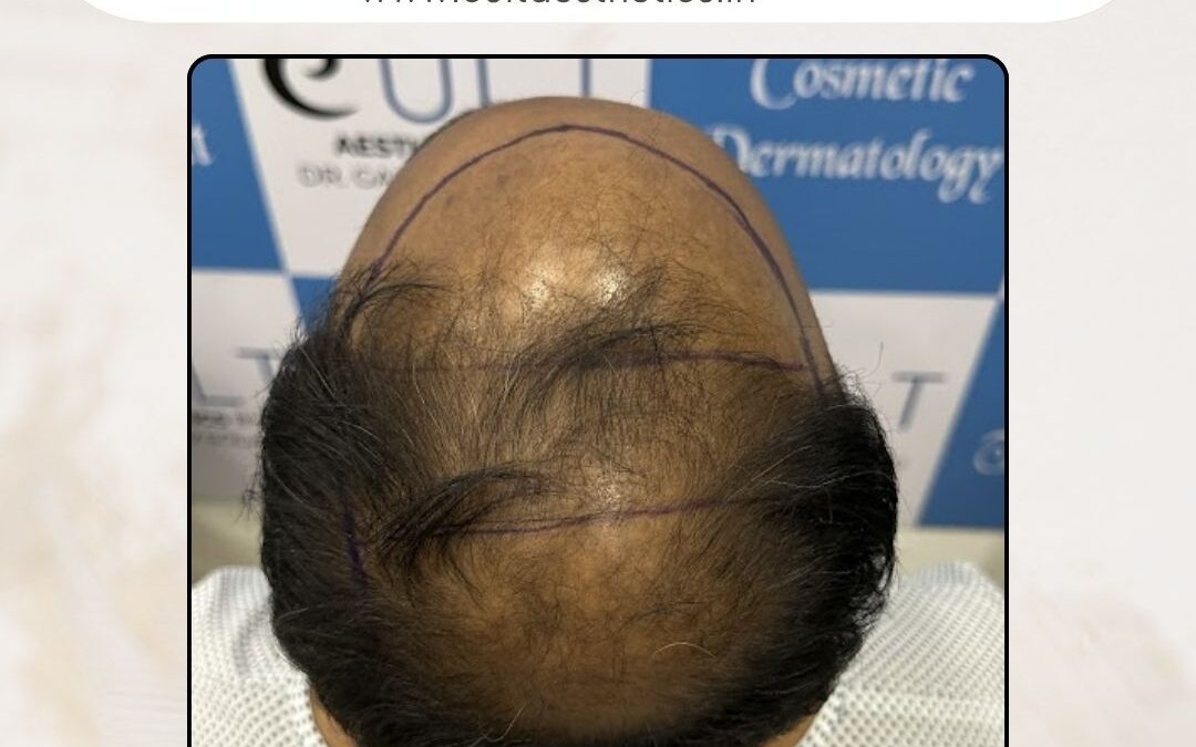 Hair Case 422 Before 3