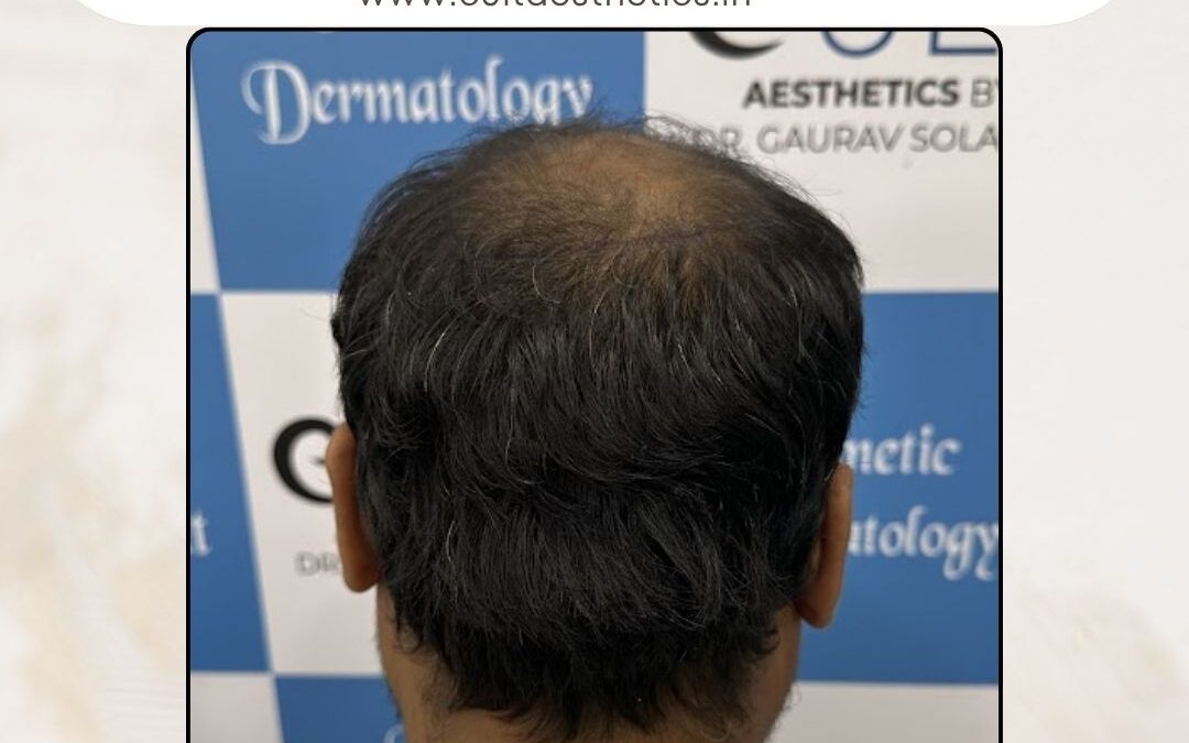 Hair Case 422 Before 4