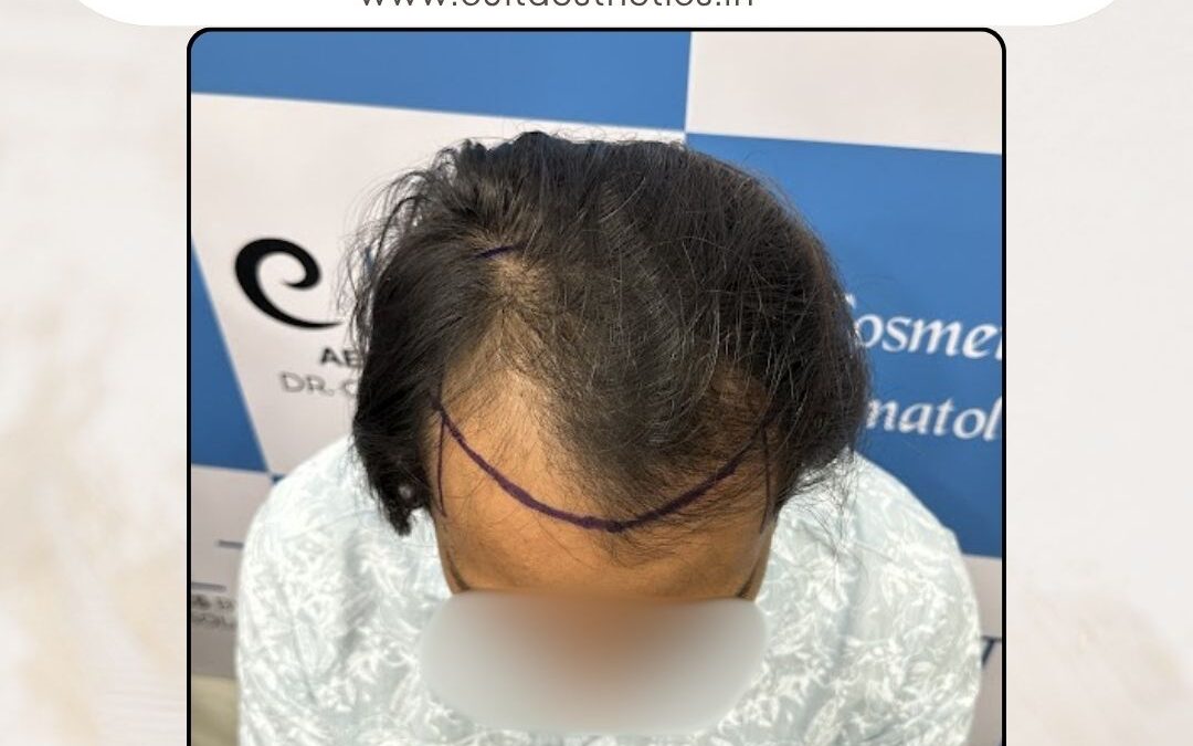 Hair Case 423 Before 4